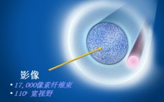 美國Endo Optiks E2眼內(nèi)窺鏡 